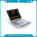 AG-BU005 CE&ISO TGC Control hospital ultrasound machine color doppler